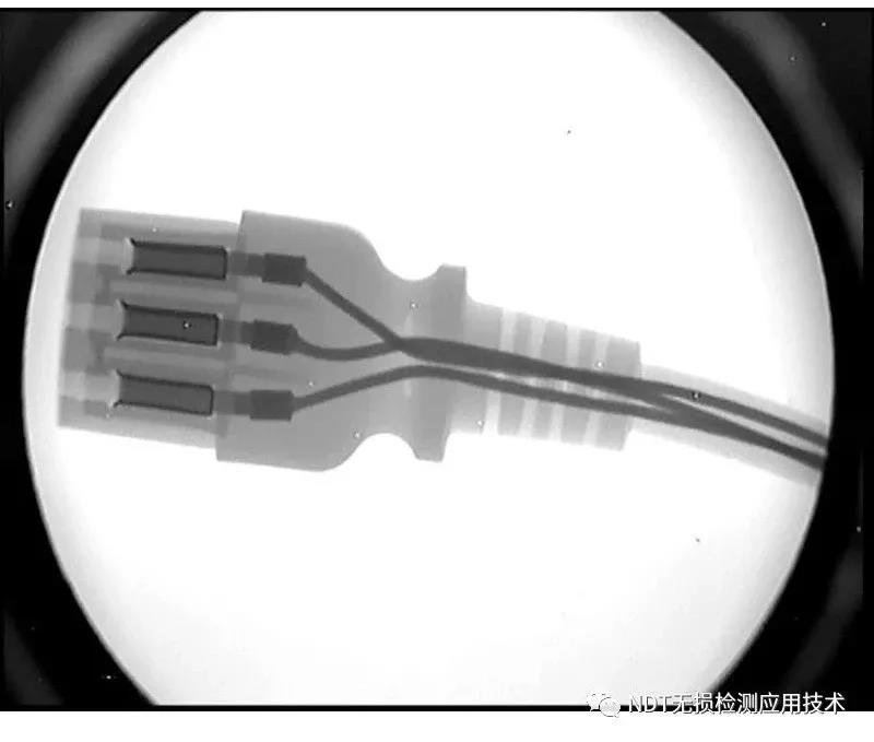 传统X光胶片成像和X射线数字成像的区分
